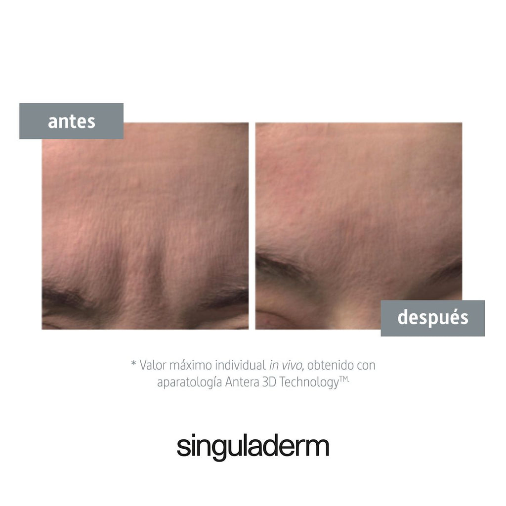 SINGULADERM, SD S.O.S Detox-Pollution 4 VIALS V2 42 Ml - View #9