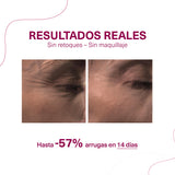 SingulaDerm XPERT S.O.S. 4 vials Shock treatment for expression wrinkles.